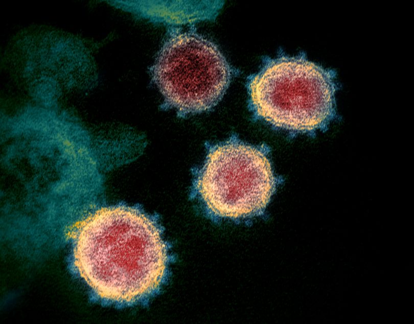 Microscopic view of COVID-19 virus.