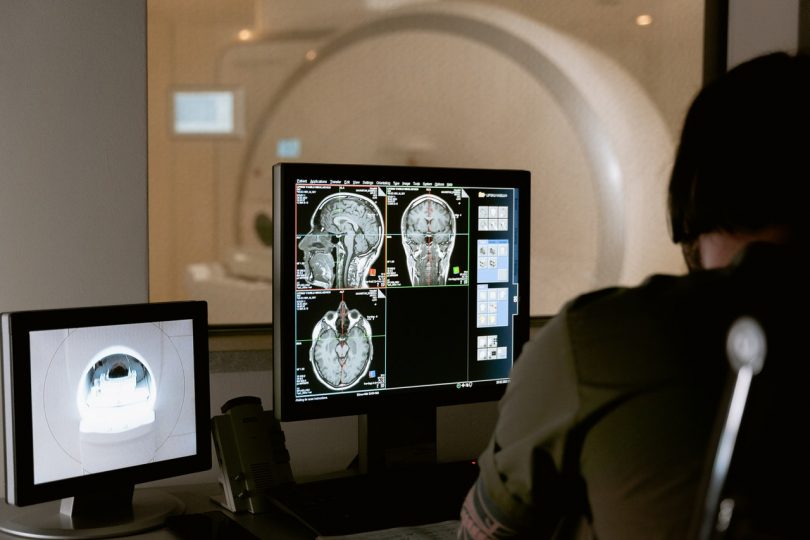 Imagining practitioner looking at MRI brain scans on monitor